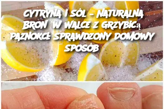 Cytryna i Sól – Naturalna Broń w Walce z Grzybicą Paznokci: Sprawdzony Domowy Sposób