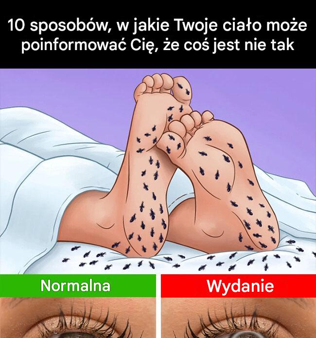 10 sposobów, w jakie Twoje ciało może poinformować Cię, że coś jest nie tak