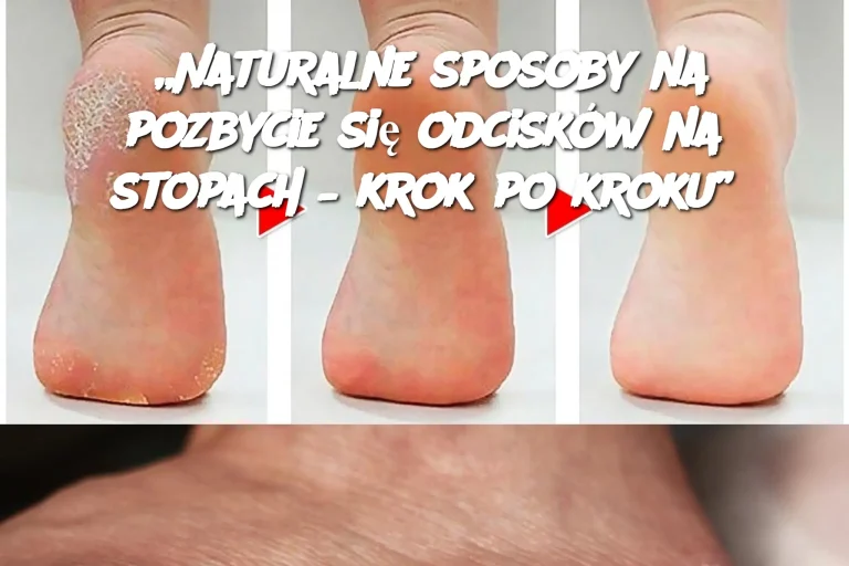 „Naturalne systemy na pozbycie się odcisków na stopach – krok po kroku”