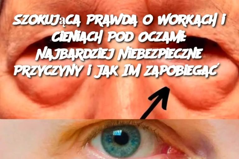 Szokująca Prawda o Workach i Cieniach Pod Oczami: Najbardziej Niebezpieczne Przyczyny i Jak Im Zapobiegać