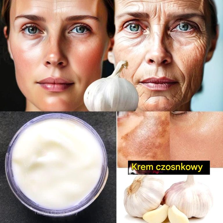 Collagen Boost: czosnkowy środek na zmarszczki, który działa nawet w wieku 70 lat!