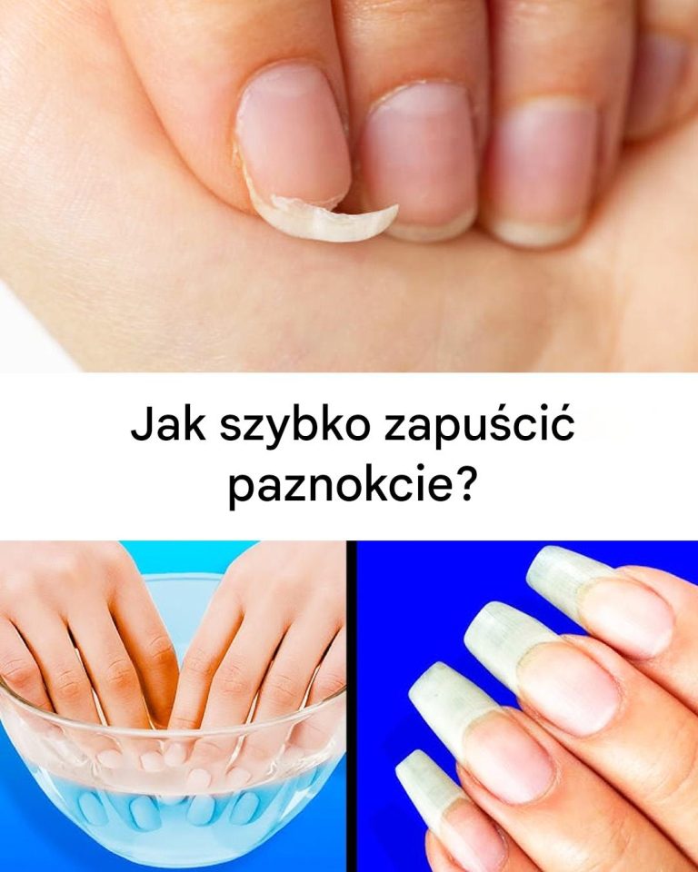 Jak przyspieszyć wzrost paznokci?