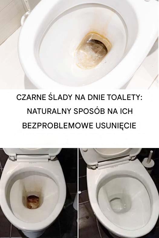 Jak usunąć czarne ślady z toalety?