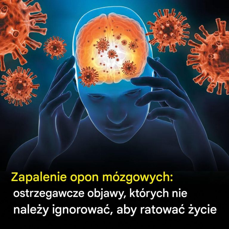 Zapalenie opon mózgowych: tych kluczowych objawów ostrzegawczych nie należy ignorować, aby ratować życie