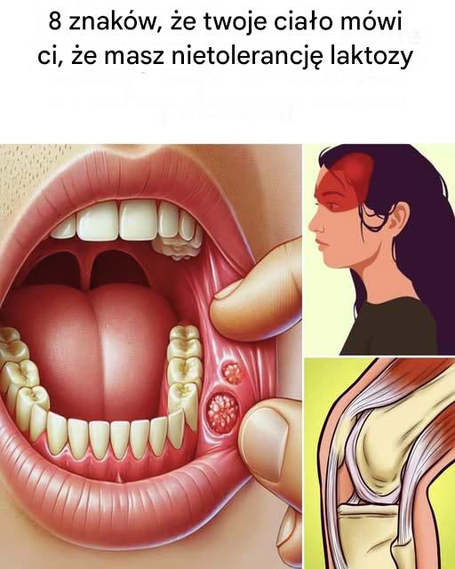 8 oznak, że Twój organizm może Ci mówić, że masz nietolerancję laktozy