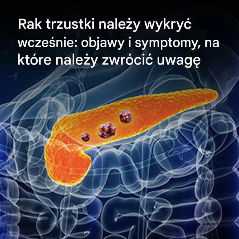 10 oznak raka trzustki, których nie należy ignorować