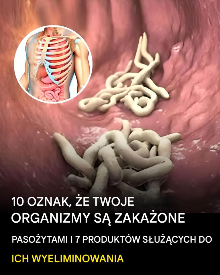 10 oznak, że w twoim ciele jest pełno pasożytów