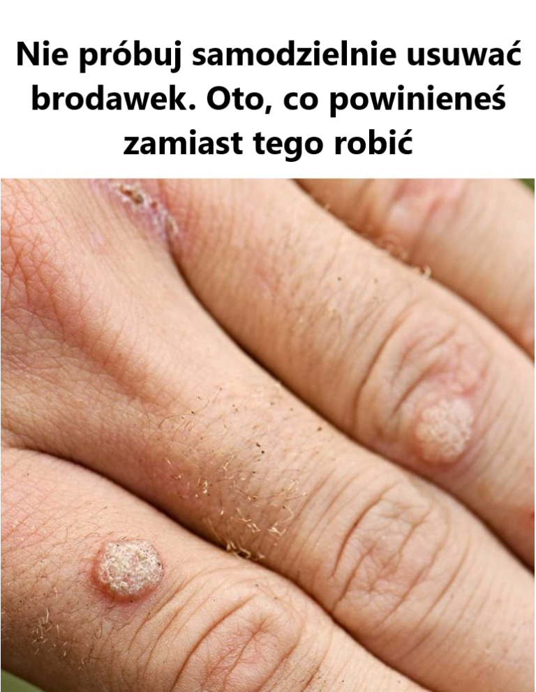 Tak się cieszę, że to znalazłem! Miałem zamiar to podważyć!