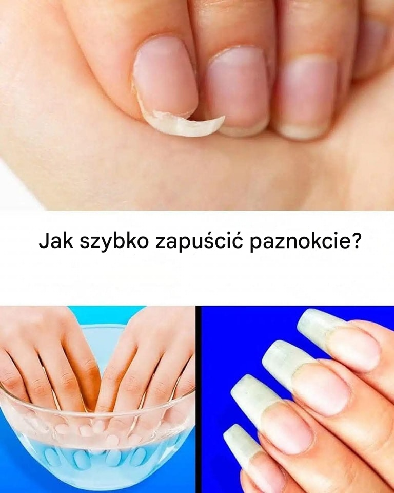 Jak przyspieszyć wzrost paznokci?