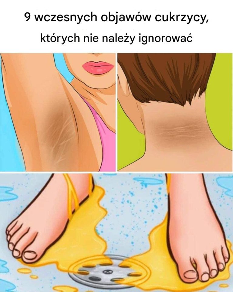 9 wczesnych objawów cukrzycy, których możesz nie zauważać