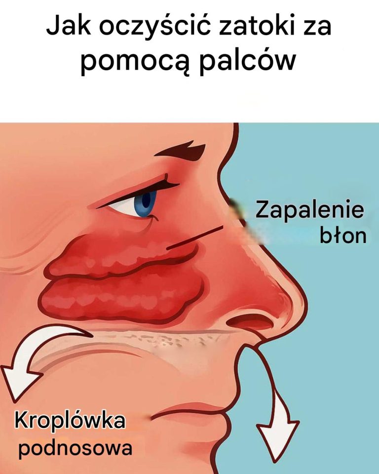 Jak oczyścić zatoki w sposób naturalny?
