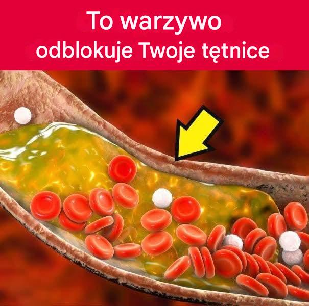 Naturalny sposób na oczyszczenie tętnic: to warzywo jest niesamowite!