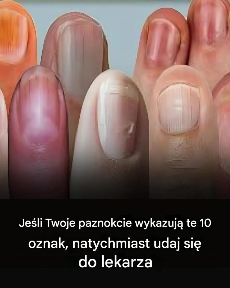 11 ostrzeżeń zdrowotnych, które mogą wysyłać Twoje paznokcie