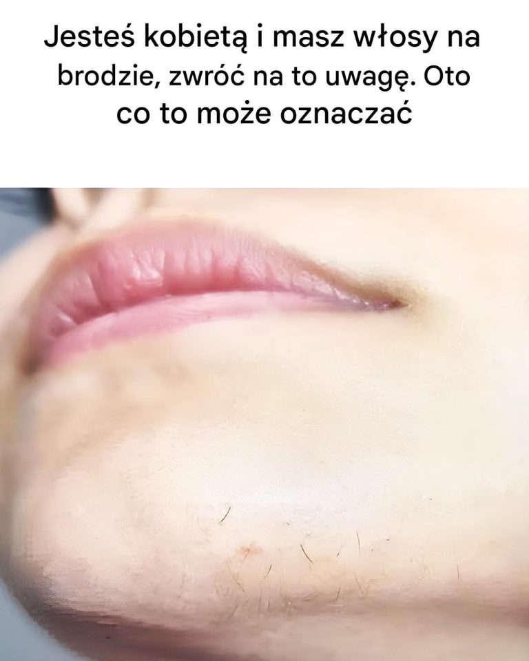 Włosy na brodzie u kobiet: co to oznacza?