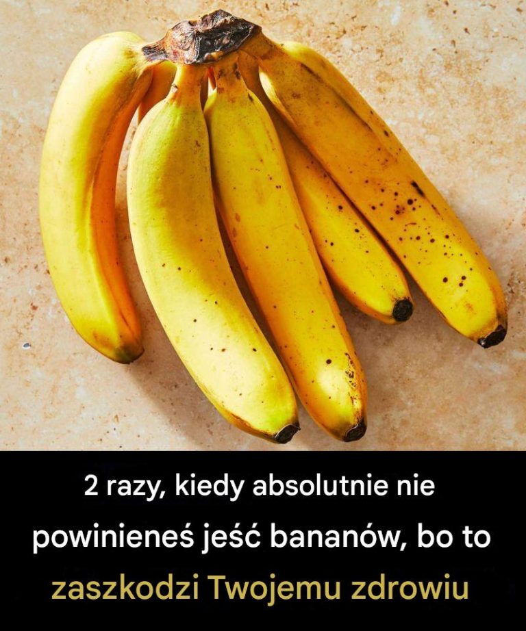 2 sytuacje, w których zdecydowanie należy unikać jedzenia bananów