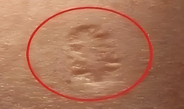 Blizny na ramieniu: co oznaczają?