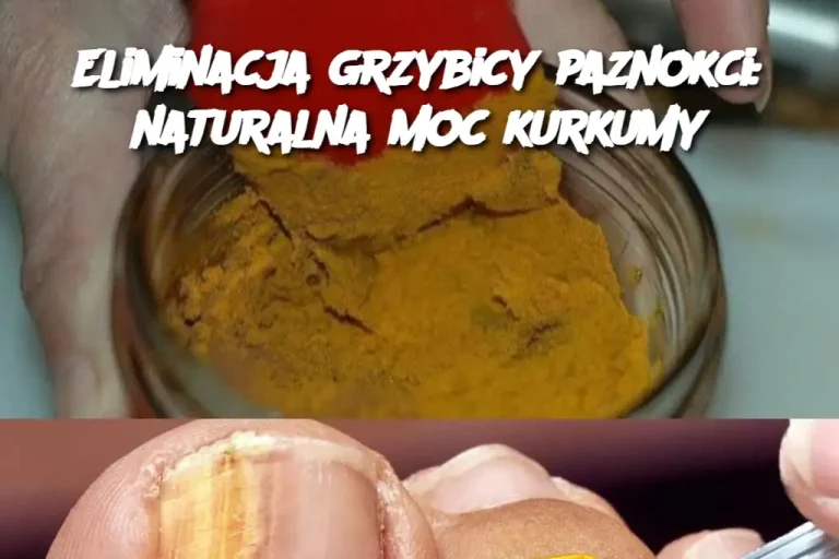 Eliminacja grzybicy paznokci: naturalna moc kurkumy