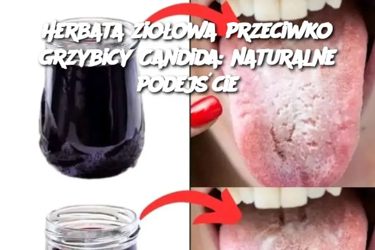 Herbata ziołowa przeciwko grzybicy Candida: naturalne podejście