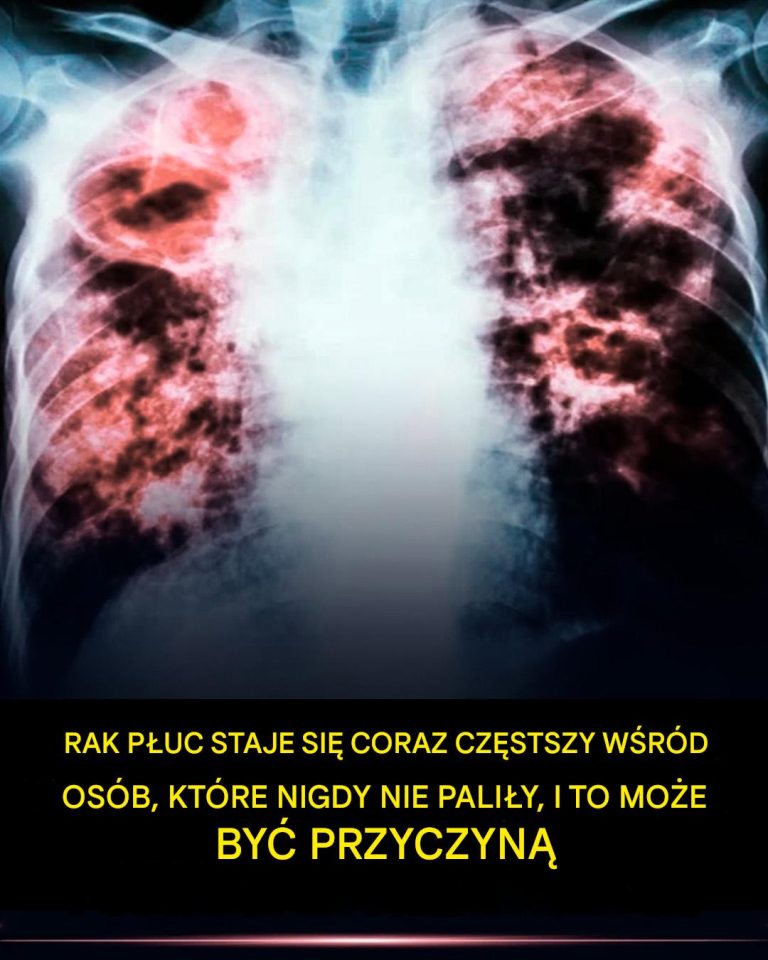 Wśród osób, które nigdy nie paliły, rośnie liczba zachorowań na raka płuc, co może być przyczyną