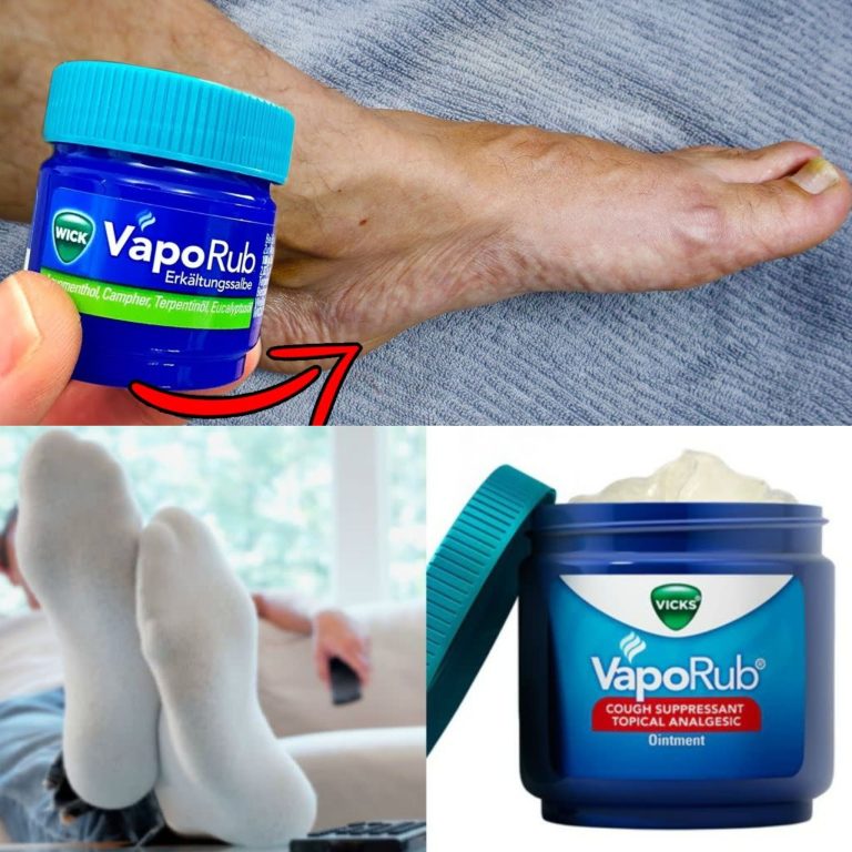 Nigdy nie sądziłam, że będę tego używać w ten sposób! 💥 (NIEZWYKŁY efekt) 🤯 – VapoRub na stopach!