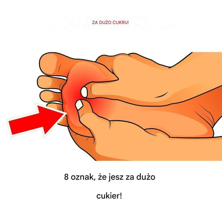 8 oznak, że jesz za dużo cukru