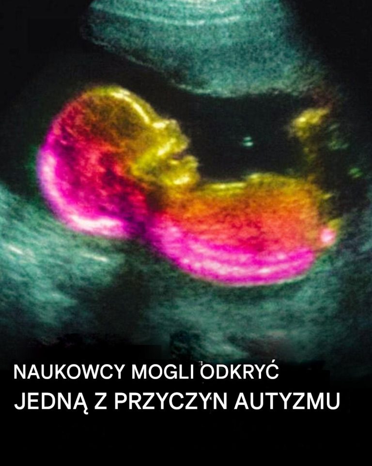 A co jeśli autyzm ma częściowo swoje źródło w łonie matki?