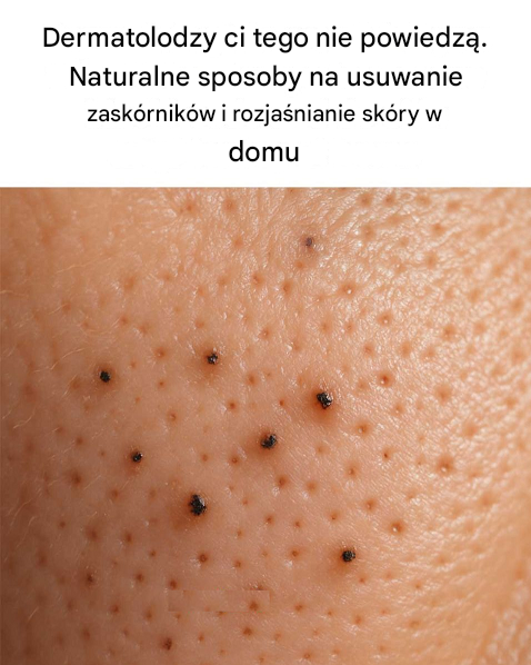 Dermatolodzy ci tego nie powiedzą