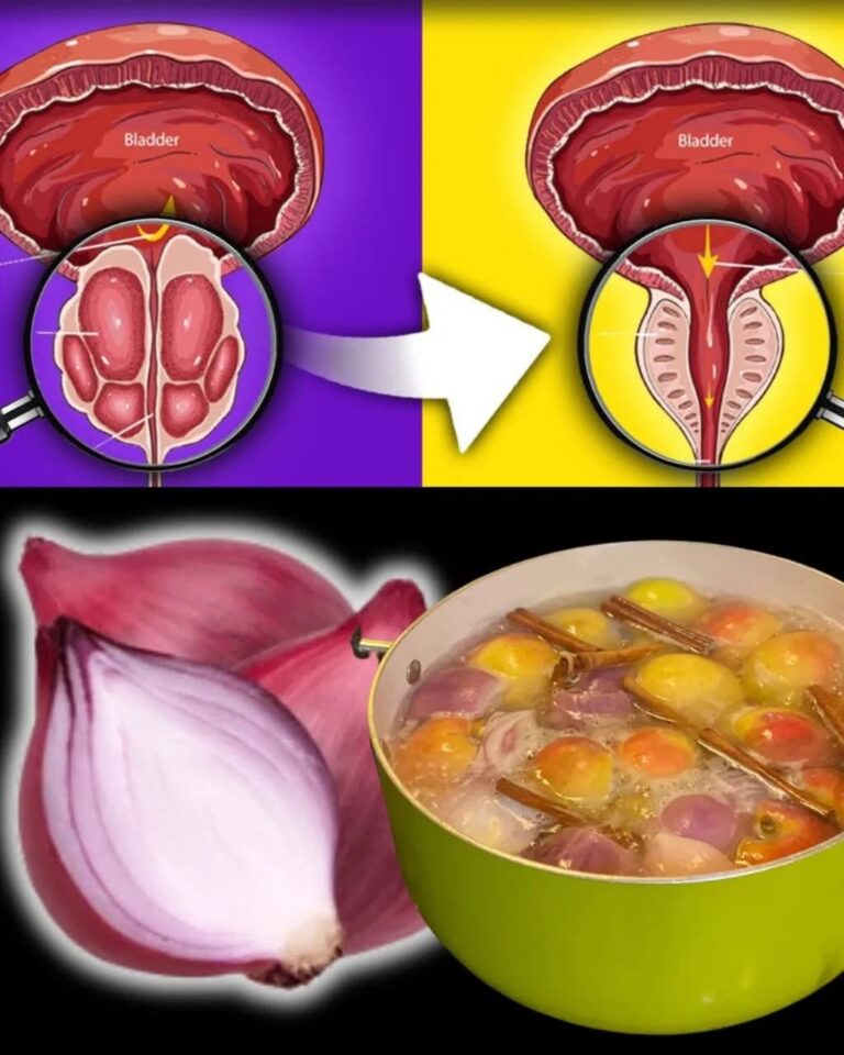 Naturalne domowe środki zaradcze: moc cebuli i skórki cebuli dla zdrowia pęcherza i prostaty