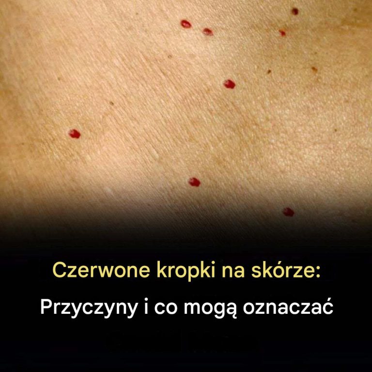 Jeśli zauważysz te czerwone kropki na skórze, oto co one oznaczają